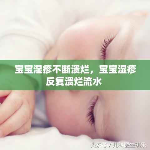 宝宝湿疹不断溃烂,宝宝湿疹反复溃烂流水