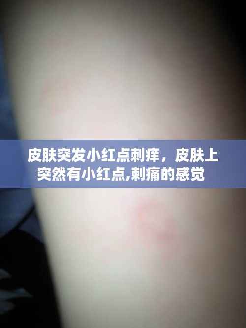 皮肤突发小红点刺痒,皮肤上突然有小红点,刺痛的感觉